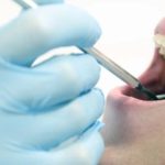 一般的な虫歯治療と吉本歯科医院の虫歯治療の違い