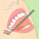 歯の神経を取った後の痛み｜高松市の吉本歯科医院