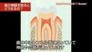 歯の神経の図
