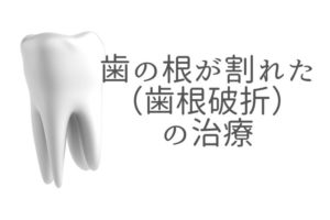 歯の根が割れた（歯根破折）の相談なら香川県高松市の吉本歯科医院