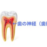 歯がしみるのは歯の神経が生きている証拠