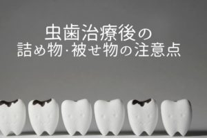歯の詰め物・被せ物の種類と価格