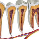 歯の神経が生きているか死んでいるかどう判断する？