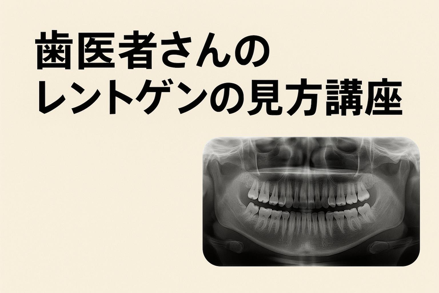 歯医者さんでのレントゲンの見方を解説｜歯周病治療なら香川県高松市