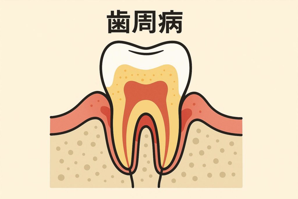 歯医者で「神経を抜きましょう」と言われる6つのケース｜香川県高松市のかみあわせ専門歯科　吉本歯科医院