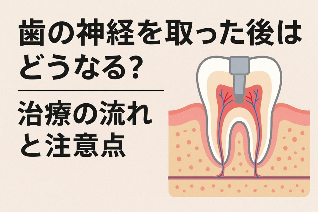 神経を取った後の歯の寿命は、治療の精度で決まります|香川県高松市の吉本歯科医院